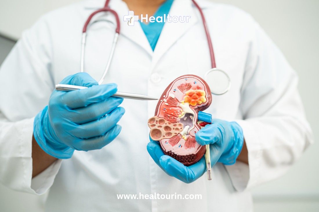 Cost of Kidney Transplantation in India – Price & Surgery 2025