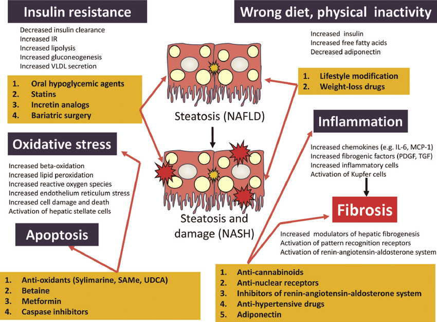 Non-Alcoholic Steatohepatitis (NASH) Management