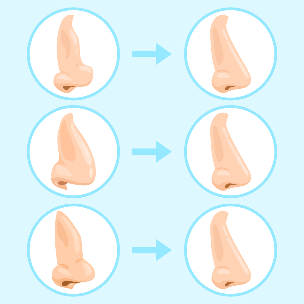Reconstructive Surgery