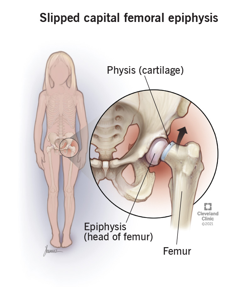 Hip Illnesses Treatment