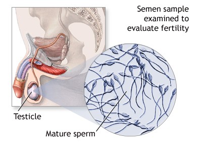 Semen Analysis