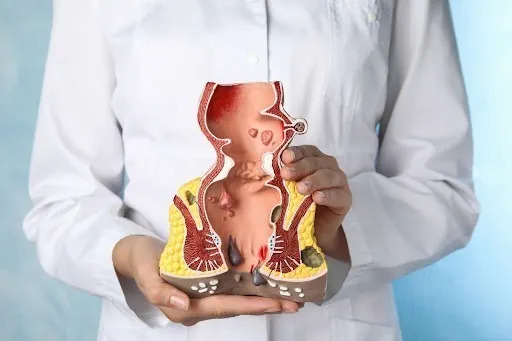 Piles Treatment